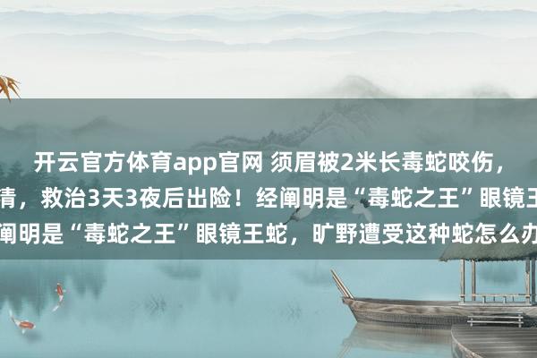 开云官方体育app官网 须眉被2米长毒蛇咬伤，用了整整13支抗蛇毒血清，救治3天3夜后出险！经阐明是“毒蛇之王”眼镜王蛇，旷野遭受这种蛇怎么办→